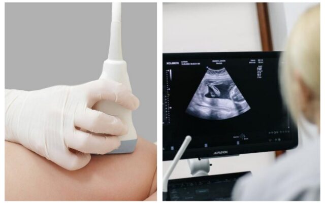 Де у Дніпрі зробити УЗД молочних залоз: адреси, графік і ціни
